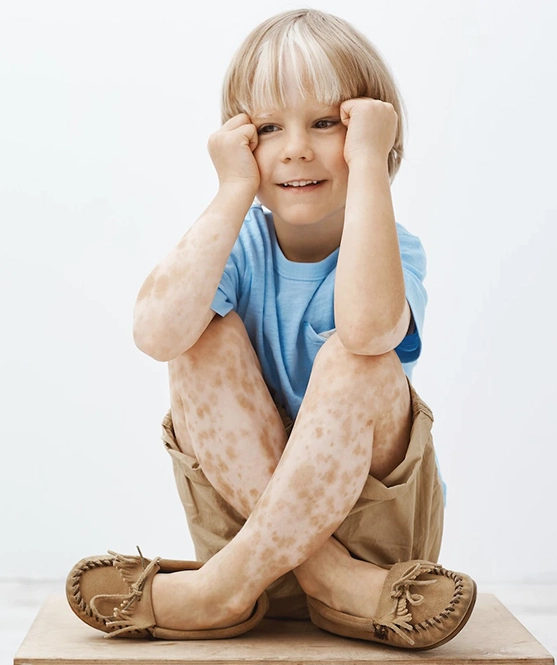Çocuk Dermatolojisi