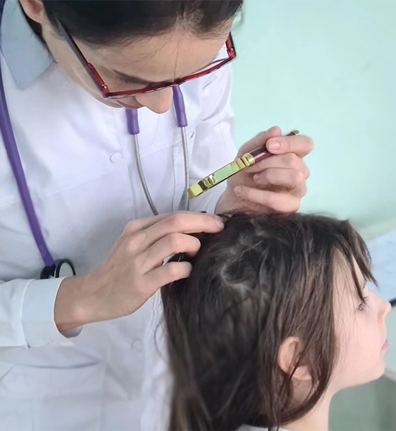 Ankara Çocuk Dermatolojisi