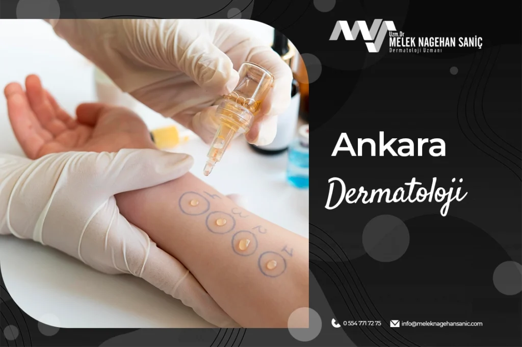 ankara-dermatoloji-001