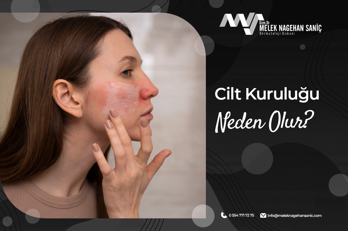 Cilt Kuruluğu Neden Olur?