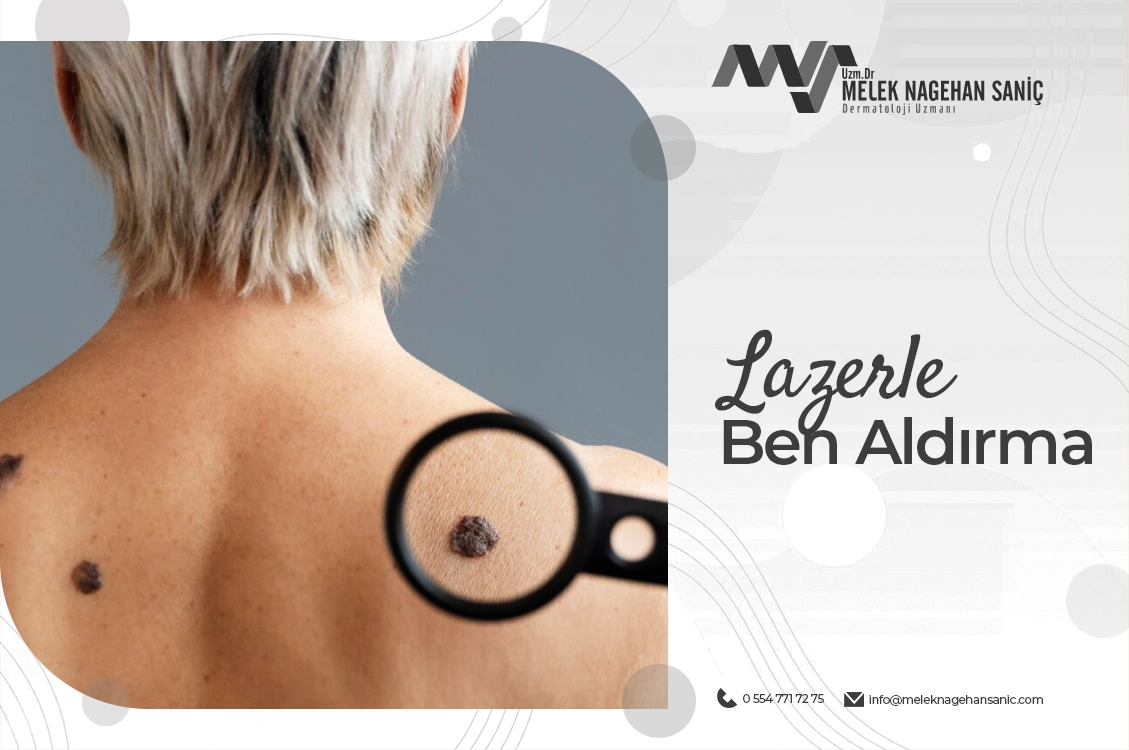 Lazerle Ben Aldırma