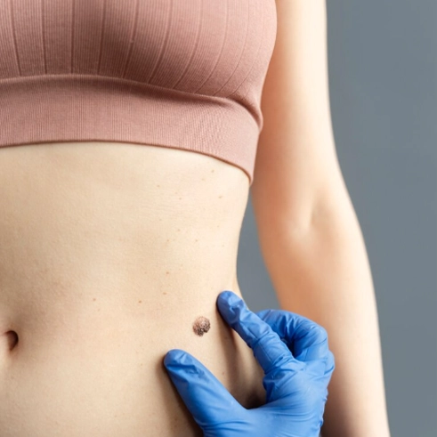 Lazerle Ben Aldırma