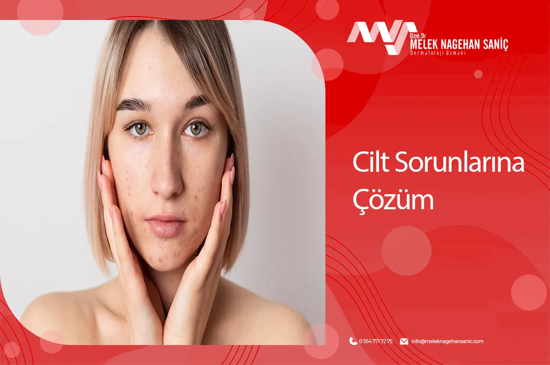 cilt sorunlarına çözüm