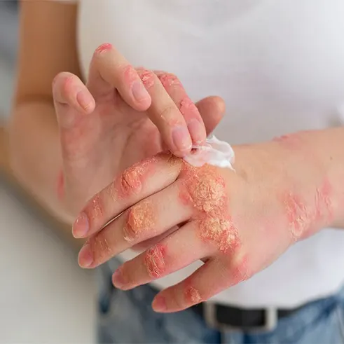 cilt sorunlarına çözüm