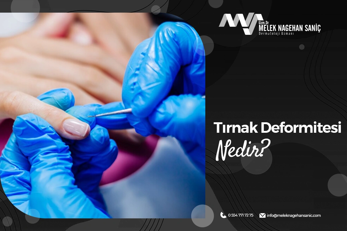 Tırnak Deformitesi Nedir?
