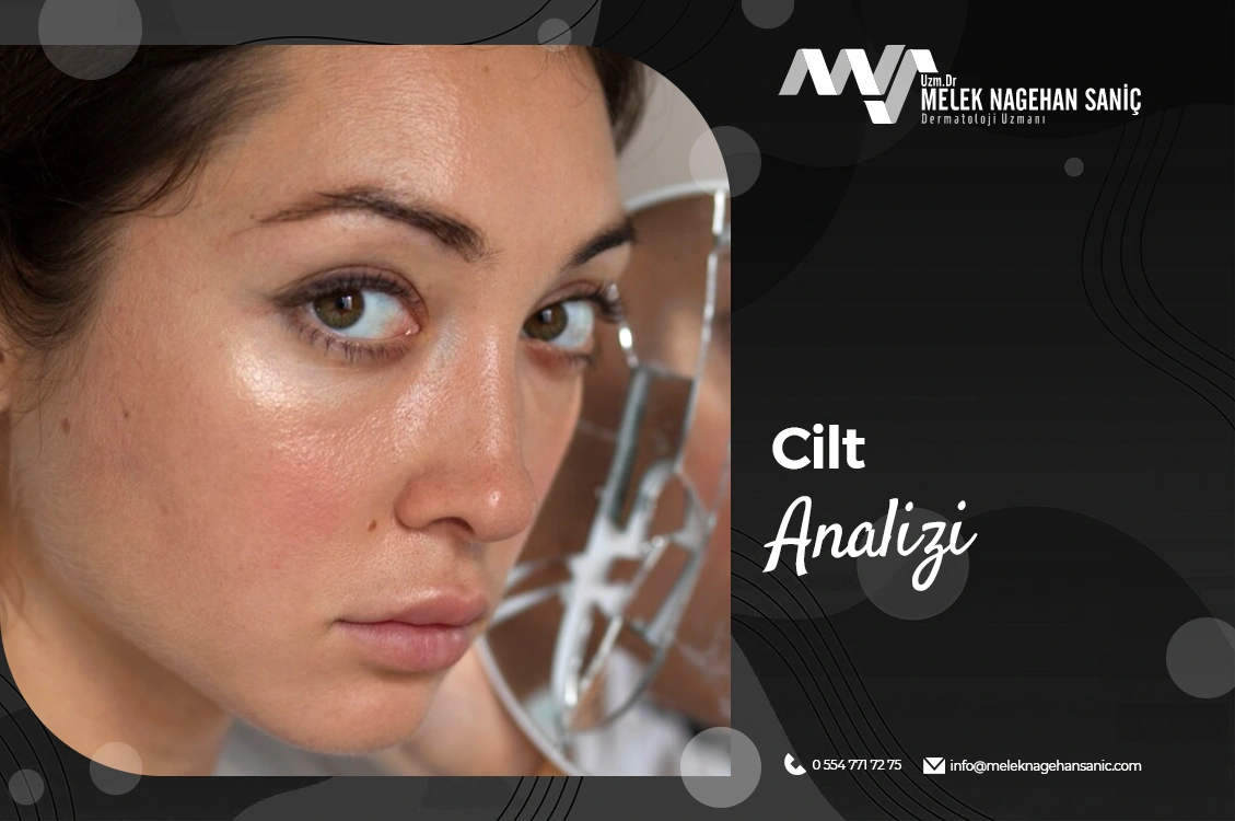 Cilt Analizi