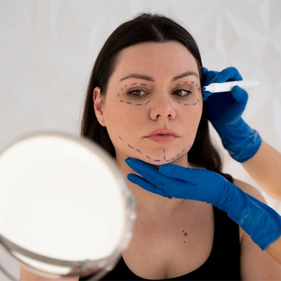 Cilt Lekeleri İçin Lazer Tedavisi Ankara