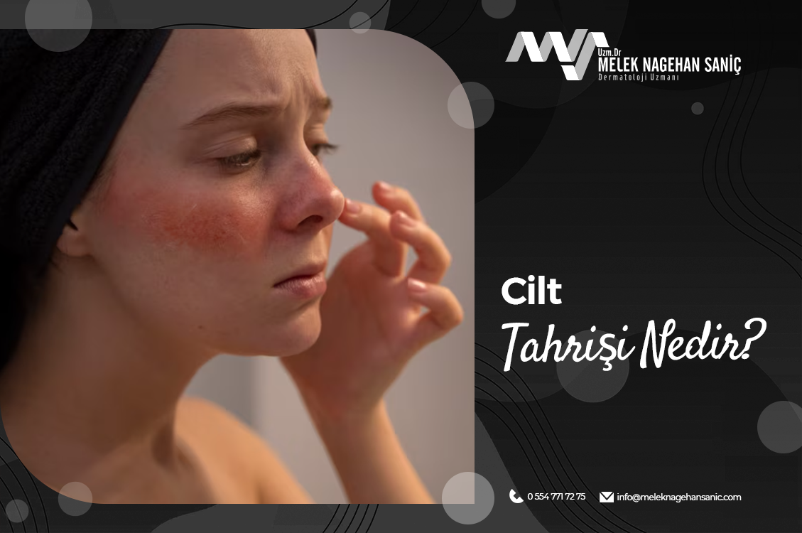 Cilt Tahrişi Nedir?