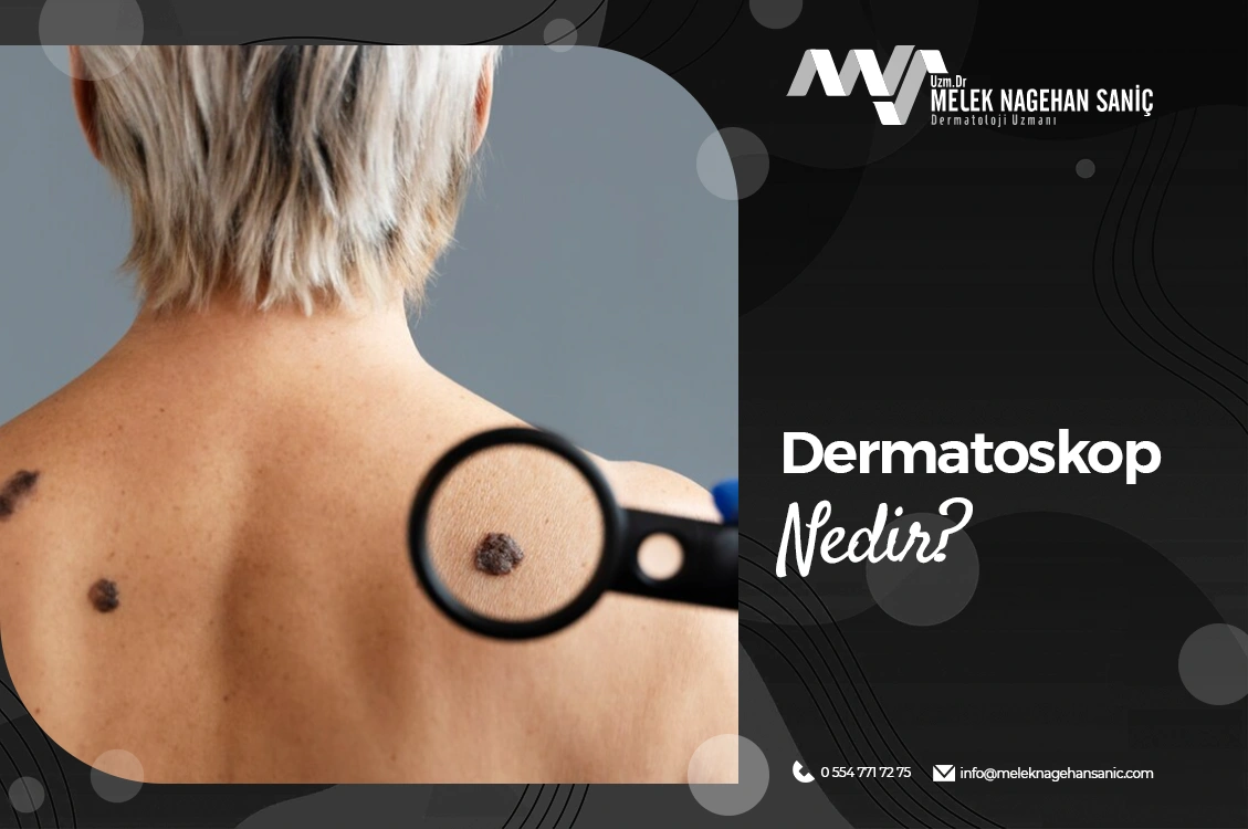 Dermatoskop Nedir?
