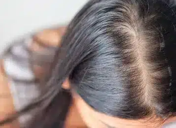 Ankara Dermatolog