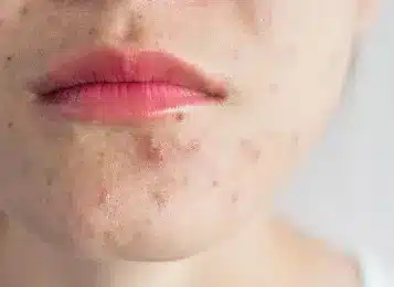 Ankara Dermatolog
