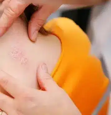 Ankara Dermatolog