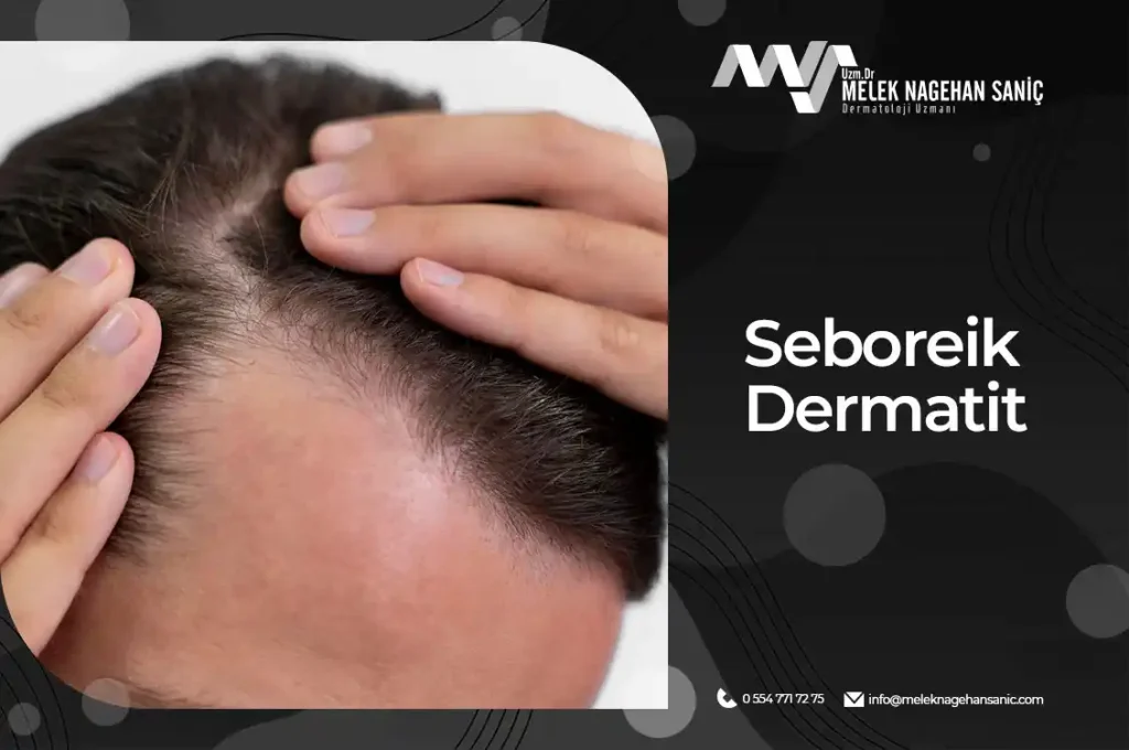 Seboreik Dermatit Nedir?