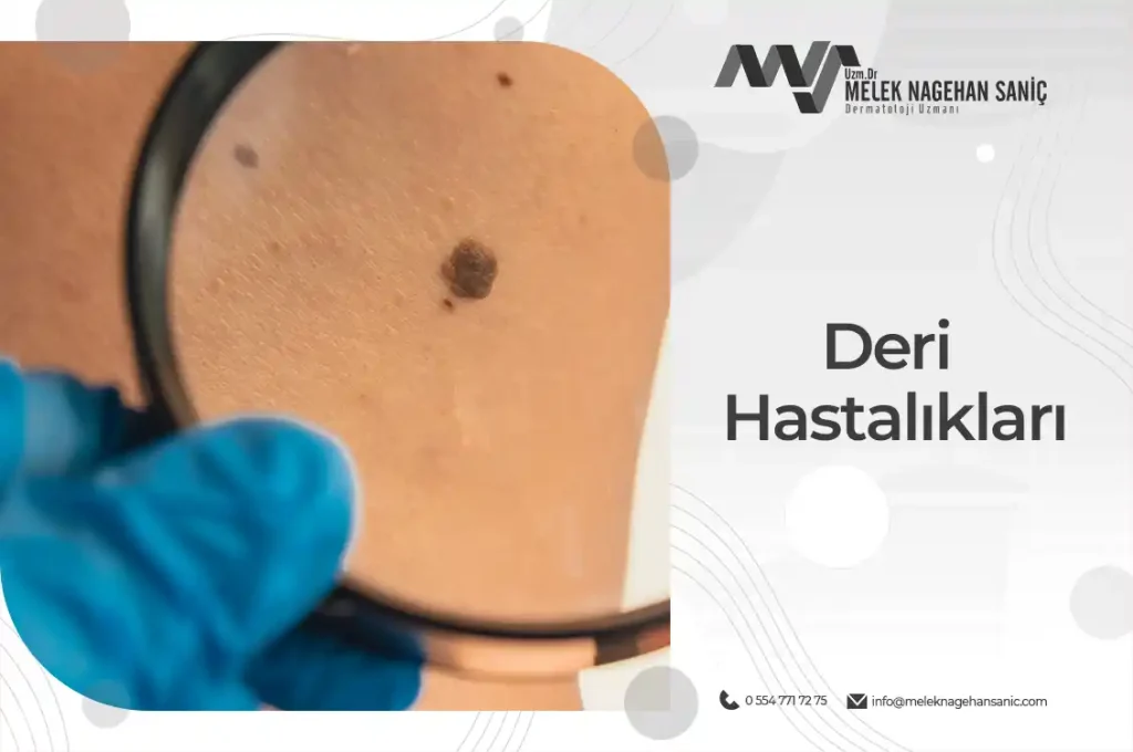 deri hastalıkları