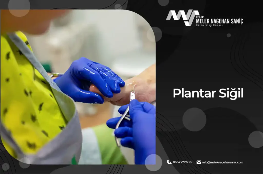 Plantar Siğil