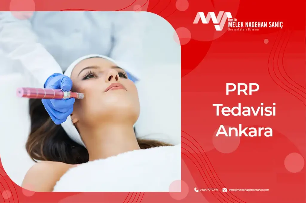 prp tedavisi ankara
